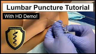 Lumbar Puncture Spinal Tap  Comprehensive Tutorial amp Demonstration [upl. by Llerral]