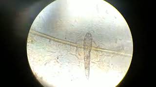 DEMODEX UNDER MICROSCOPE [upl. by Sharyl]