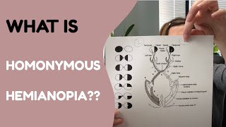 What is Homonymous Hemianopia [upl. by Kolb]