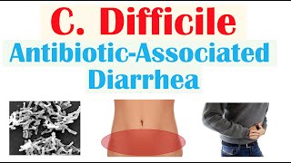 Clostridium Difficile AntibioticAssociated Diarrhea Risk Factors Symptoms Diagnosis Treatment [upl. by Ociram]