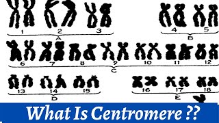 Centromere And Kinetochore  How we use centromere to classify chromosomes   Histology [upl. by Aggarwal42]