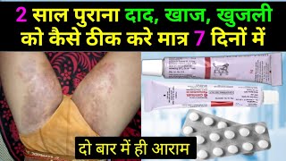 2 साल पुराने दाद खाज खुजली को कैसे ठीक करें  fungal infection in private parts  khujli ki dawa [upl. by Cherlyn848]