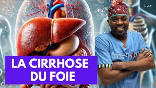 Tout ce que vous devez savoir sur La cirrhose du foie par docteursourire [upl. by Nimajnab622]