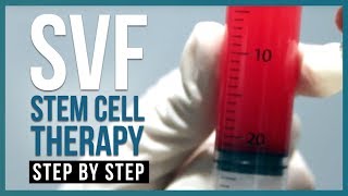 Stromal Vascular Fraction Stem Cell Therapy SVF Therapy  StepbyStep [upl. by Htebazileharas]