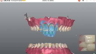 DEXIS™IS ScanFlow  Vídeo 4 como escanear a mordida [upl. by Yoshio]