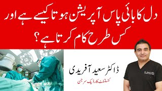 How Does Heart Bypass Work Coronary Artery Bypass Graft Procedure  Dr Saeed Afridi [upl. by Anib]