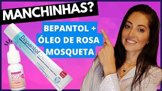 Misturinha caseira de Bepantol Derma e Óleo de Rosa Mosqueta funciona [upl. by Enitsuj350]