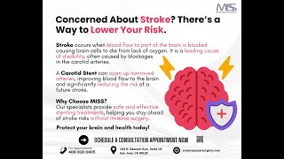 Prevent Stroke with Carotid Stenting at MISS [upl. by Cathy]