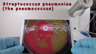 Alpha Hemolysis and Identification of Streptococcus pneumoniae [upl. by Dinah]