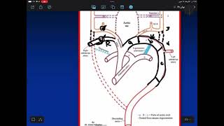 cardiology  formation of aortic archs [upl. by Skoorb]