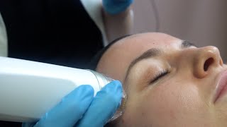 How microneedling with RF tightens skin microneedling endymed rf [upl. by Ahsram]