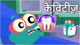 कैविटीज़  दांतों में कीड़े  Cavities In Hindi  DrBinocs Show  Educational Videos For Kids [upl. by Anigal637]