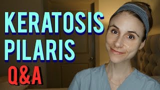 KERATOSIS PILARIS QampA WITH A DERMATOLOGIST Dr Dray [upl. by Yeclek713]