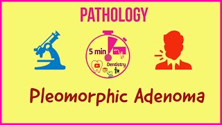 PLEOMORPHIC ADENOMA  ORAL PATHOLOGY  QUICK LECTURE  5 min DENTISTRY [upl. by Hoisch]