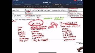 Seizure vs pseudoseizure [upl. by Ealasaid]