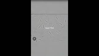 Sperm cell morphology and sperm under microscope [upl. by Hoi]