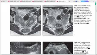 GYNAE IMAGING DIAGNOSTIC IMAGING SERIES [upl. by Dnomder]