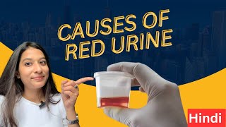 Causes of Red Urine  What is Hematuria by Dr Prachi Mahajan [upl. by Angelique]