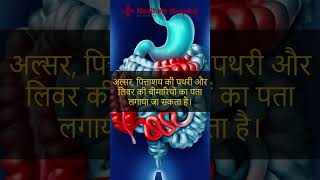 पेट का अल्ट्रासाउंड क्यों आवश्यक है  Abdominal Ultrasound  Best Gastro Hospital in Kanpur [upl. by Bellaude124]