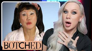 BOTCHED Can transracial plastic surgeries be reversed volume 1 [upl. by Williamson]