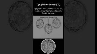 Cytoplasmic Strings CytS in Blastocyst Embryoblastocyst [upl. by Chill]