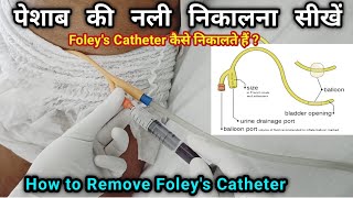 Urinary Catheter Remove कैसे करें  How to remove foleys Catheter  Foleys Catheter कैसे निकाले [upl. by Calysta]