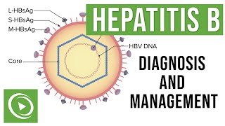 Hepatitis B Overview Clinical Presentation Diagnosis and Management  Lecturio [upl. by Falkner]