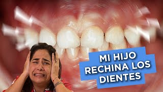 Mi HIJO RECHINA LOS DIENTES ¿QUÉ HAGO [upl. by Hannah476]