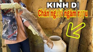 LẠNH CẢ NGƯỜI KHI XEM ANH VƯ CẮT CHÂN HOẠI TỬ VỀ NGÂM 85 LÍT RƯỢU NGÔ  CẢNH BÁO NGƯỜI XEM [upl. by Eelyahs]