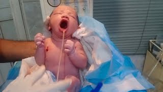 New born baby inhale meconium and amniotic fluid take action remove all by suction clean baby 🖤 [upl. by Corson]