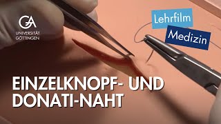 Einzelknopf und DonatiNaht [upl. by Jariah]