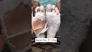 Repair cracked Herls in 1 DayGet Ride of Dry Feet Get Fair amp soft Feet instantlyshortsskincare [upl. by Teresa]