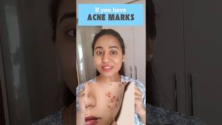 Dark Spot Removal Serums skincaretelugu shortsfeed darkspotremoval [upl. by Morgenthaler]