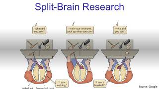 Early Split Brain Patient Exhibiting Conflict [upl. by Ecnaralc]