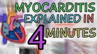 WHAT IS MYOCARDITIS MYOCARDITIS EXPLAINED IN 4 MINUTES  CAUSES SYMPTOMS DIAGNOSIS TREATMENT [upl. by Dilks]