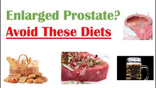 Foods to Avoid with Enlarged Prostate  Reduce Symptoms and Risk of Prostate Cancer [upl. by Genni]