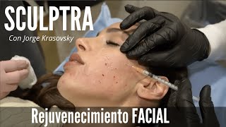 SCULPTRA Antes y Después  Lo último en Rejuvenecimiento Facial con el Dr Jorge Krasovsky [upl. by Kovacs]