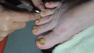 Refresh Her Toenails How to Change Yellow to Beautiful Colors [upl. by Maguire]