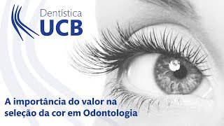 Cores em odontologia a importância do valor [upl. by Hendry]