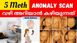 Anomaly scan Malayalam  5 Month Scanning during Pregnancy  Second Trimester Scan [upl. by Yleve]