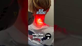 Class 4 laser therapy is easing neck pain after a car accident Start your recovery now 💪 [upl. by Eizeerb]