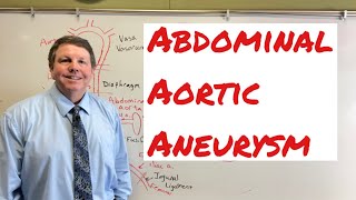 Abdominal Aortic Aneurysm What You Need To Know [upl. by Annaeiluj508]