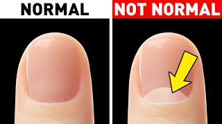 Look at Your Nails and Youll Realize How Rare Your Body Is [upl. by Larina]