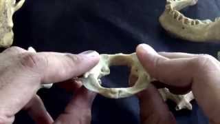 first cervical vertebra  The atlas [upl. by Atnauqahs]