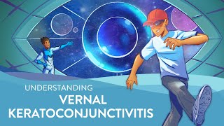 Understanding Vernal Keratoconjunctivitis VKC [upl. by Atinet]