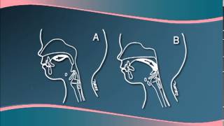 Chapter 3  Understanding Cleft LipPalate Physiology [upl. by Oderfodog]