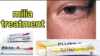 treatment of milia acne and dark sports  FLYTRO and skin A cream review [upl. by Maillliw36]