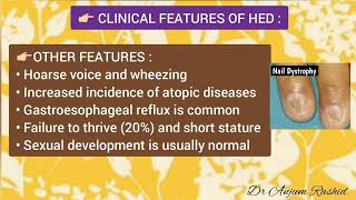 Ectodermal Dysplasia Symptoms Types Causes Diagnosis Treatment amp Life Expectancy [upl. by Mohun]