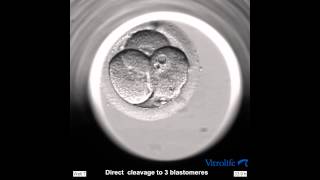 EmbryoScope Embryo Development  Direct Cleavage [upl. by Lebazi]