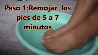 Limpieza de pies pedicure [upl. by Knitter]